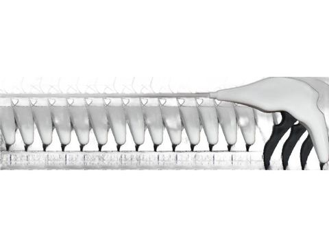 Tacknet — Endoscopic Mesh Tacker, Suture Planet